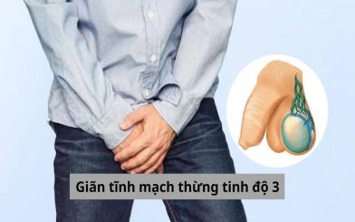 TƯ VẤN: “Giãn tĩnh mạch thừng tinh độ 3 có nguy hiểm không?”