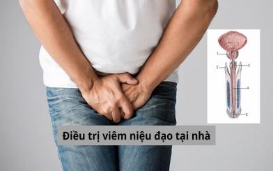 Điều trị viêm niệu đạo tại nhà liệu có nên áp dụng?
