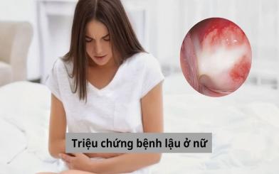 Phát hiện nhanh triệu chứng bệnh lậu ở nữ giới