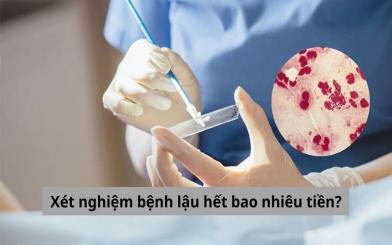 Xét nghiệm bệnh lậu hết bao nhiêu tiền, cập nhật chi tiết các hạng mục