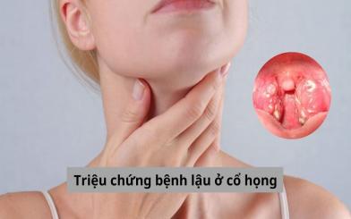 Làm sao để nhận biết triệu chứng bệnh lậu ở cổ họng?