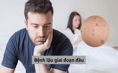 Những thông tin và hình ảnh bệnh lậu giai đoạn đầu cần biết!
