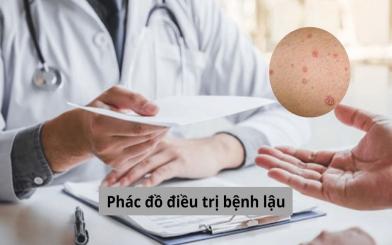 Phác Đồ Điều Trị Bệnh Lậu: Cập Nhật Những Tiến Bộ Y Học Mới Nhất