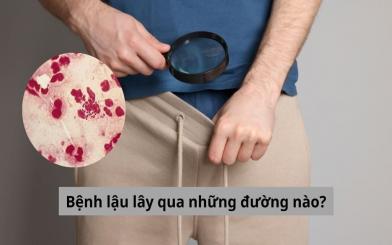 Bệnh lậu lây qua những đường nào? Có dễ bị lây nhiễm không?