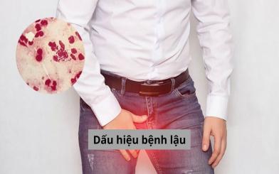 Tìm hiểu về dấu hiệu bệnh lậu ở nam và nữ - Bác sĩ giải đáp