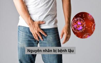 Nguyên nhân bị bệnh lậu tuyệt đối cần đề phòng