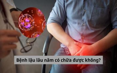 Gỡ rối băn khoăn: Bệnh lậu lâu năm có chữa được không?