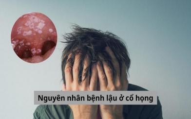 Nguyên nhân bệnh lậu ở cổ họng người bệnh cần biết để phòng tránh