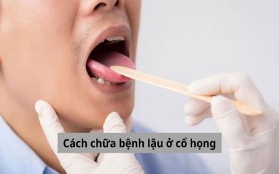 Cách chữa bệnh lậu ở cổ họng: Cập nhật chi tiết từ A đến Z