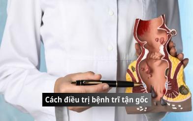 Bật mí các cách điều trị bệnh trĩ tận gốc hiện nay
