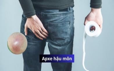 Apxe hậu môn: Triệu chứng, nguyên nhân và cách điều trị