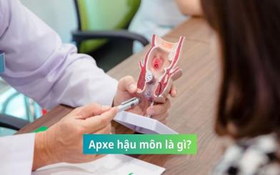 [Giải đáp] Apxe hậu môn là gì? Có thể chữa khỏi không?
