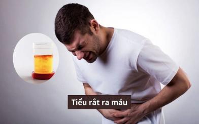 Cảnh báo: Tiểu rắt ra máu không chỉ đơn thuần là triệu chứng của viêm đường tiết niệu.
