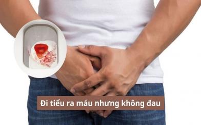 Đi tiểu ra máu nhưng không đau rất nguy hiểm - không thể chủ quan 
