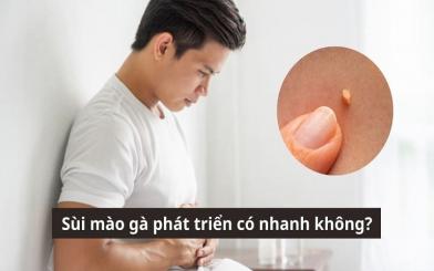 Chuyên gia giải đáp: Sùi mào gà phát triển có nhanh không? 