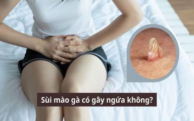 Sùi mào gà có gây ngứa không? Các giải pháp phòng ngừa bệnh hiệu quả