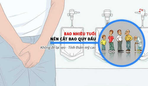  Tùy từng đối tượng thời gian cắt bao quy đầu sẽ khác nhau