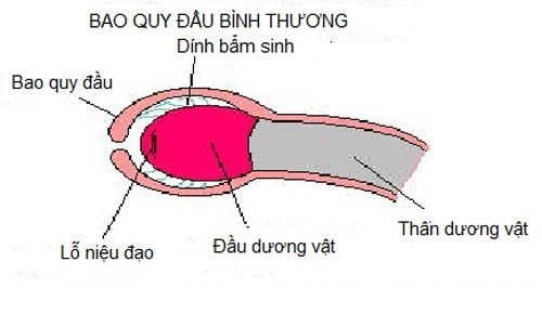 Dính bao quy đầu 