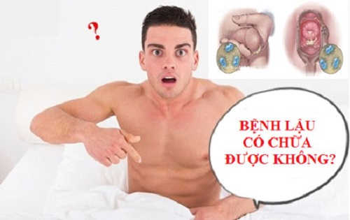 Bệnh lậu có chữa được không?