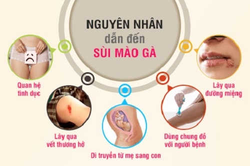 Bị sùi mào gà có con được không? Điều trị như thế nào?