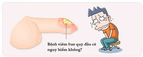 Bệnh viêm bao quy đầu có nguy hiểm không?