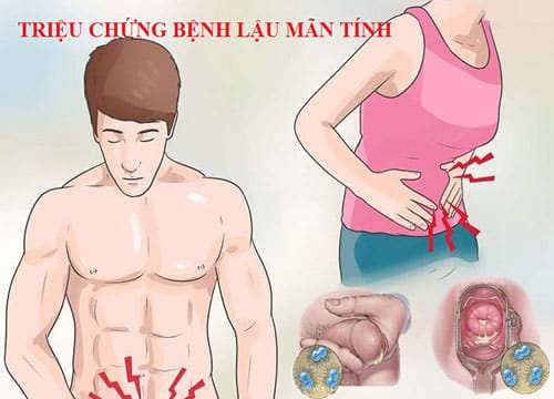 Bị lậu giai đoạn mãn tính có chữa được không?