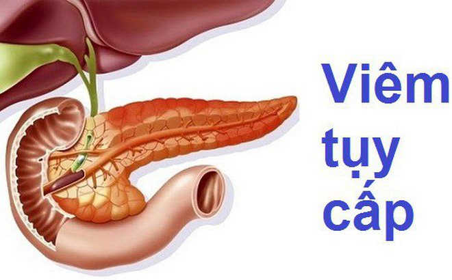 Bụng dưới to và mềm do bệnh viêm tụy