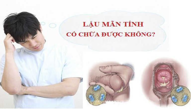 Cách điều trị bệnh lậu khỏi hoàn toàn