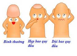 Dài bao quy đầu