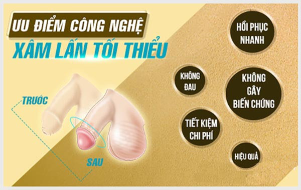 Ưu điểm của thủ thuật xâm lấn tối thiểu cắt bao quy đầu kiểu Hàn Quốc