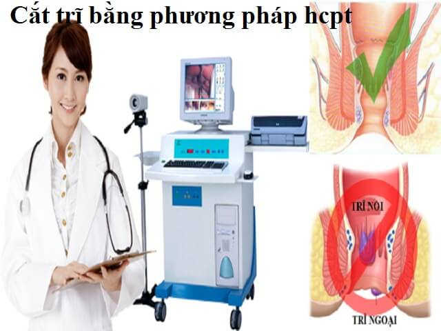 Chi phí mổ trĩ ngoại đắt không? Cách chăm sóc sau mổ trĩ