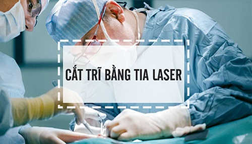 Cắt trĩ bằng phương pháp truyền thống Laser