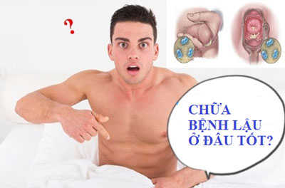 Chữa bệnh lậu ở đâu tốt?