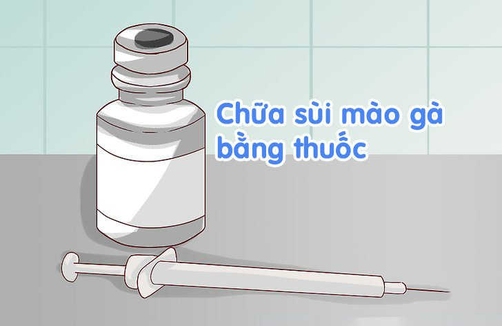 Chữa sùi mào gà bằng thuốc