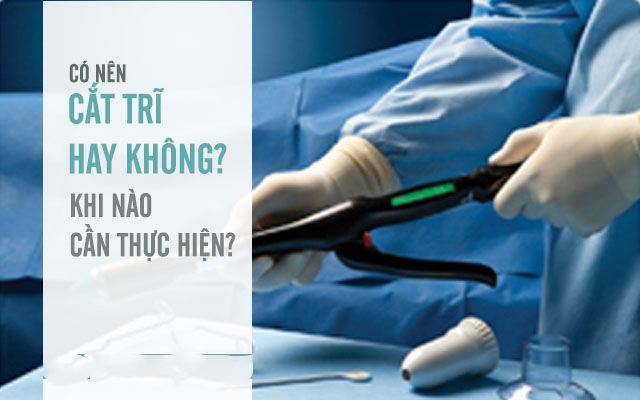 Có nên phẫu thuật cắt trĩ, cắt trĩ bằng phương pháp nào tốt nhất