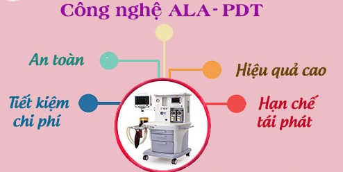 Điều trị bằng kỹ thuật ALA – PDT