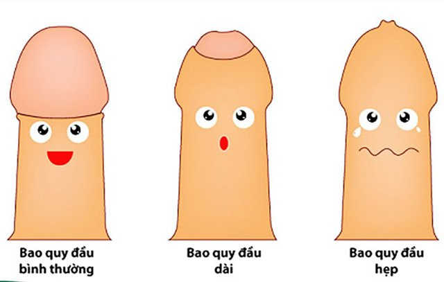 Dài hoặc hẹp bao quy đầu