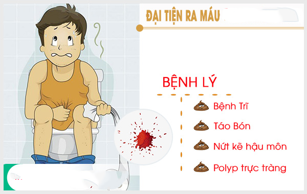 Đi đại tiện ra máu đông: 80% bệnh lý nguy hiểm