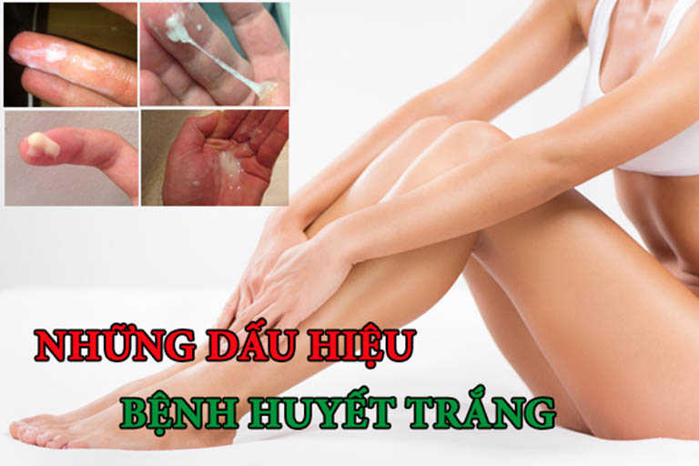 Bị huyết trắng nên ăn gì, kiêng gì tốt nhất?