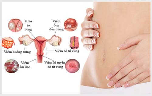 Viêm nhiễm phụ khoa để lâu ngày có chữa khỏi không, có nguy hiểm không