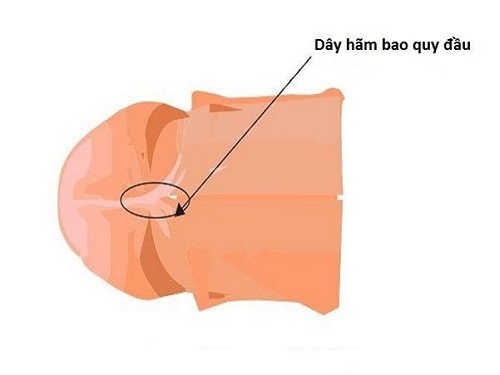 Dây hãm bao quy đầu