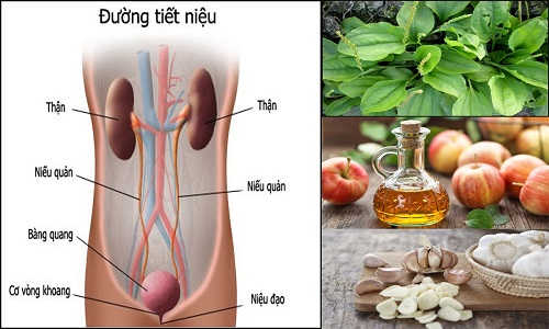 Điều trị viêm đường tiết niệu