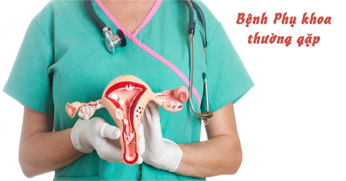 Điều trị bệnh viêm phụ khoa sau sinh bằng cách nào?
