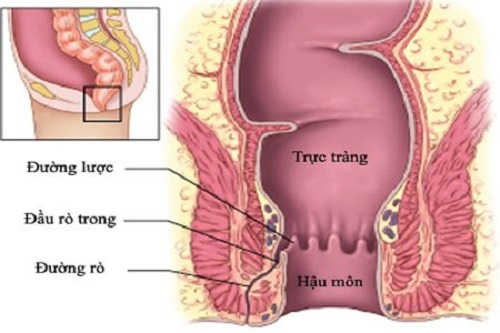 Hậu môn trực tràng