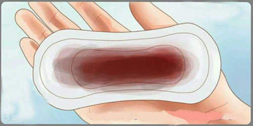 Khí hư màu nâu giữa kì kinh 
