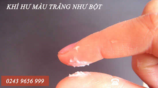 Khí hư màu trắng đặc như bột