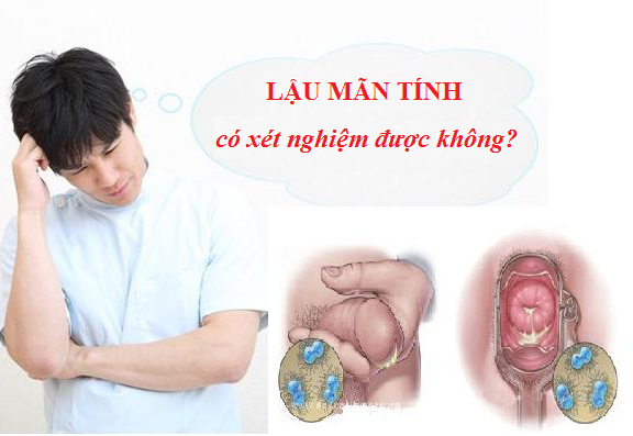 Trường hợp lậu mãn tính có xét nghiệm được không?