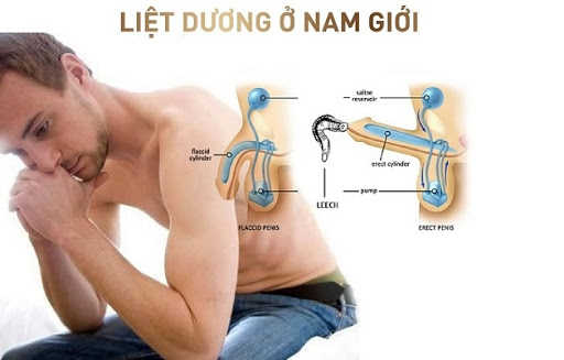 Tìm hiểu: Liệt dương và cách chữa liệt dương tại nhà
