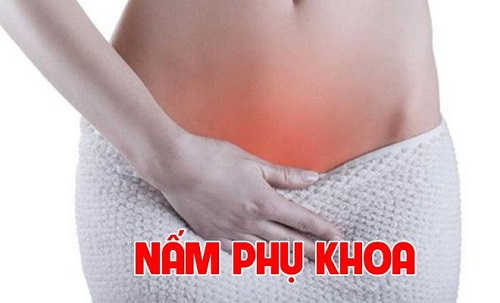 Nấm phụ khoa
