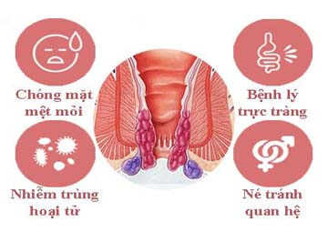 Dấu hiệu bệnh trĩ nội là cơ sở để người bệnh nhận biết sớm